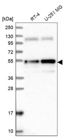 ANKRD10 Antibody, Novus Biologicals:Antibodies:Primary Antibodies